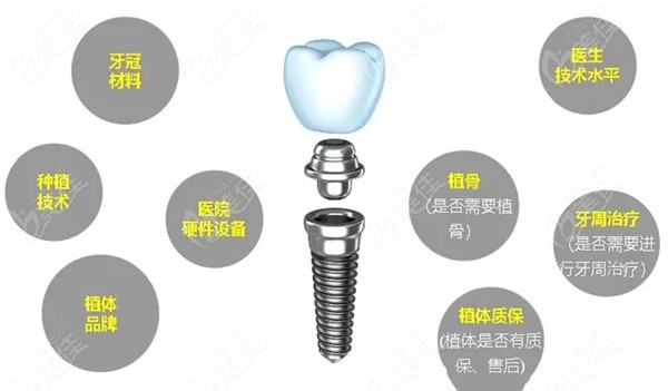 牙齿集采最新动态，政策进展及市场反应分析